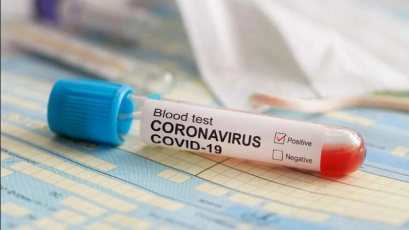 تسجيل 26 اصابة جديدة بفيروس كورونا!!